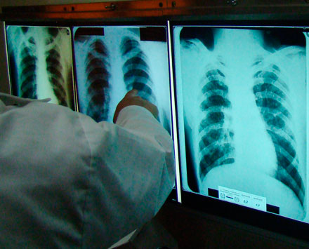 evaluacionradiologica